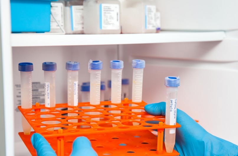 Liposomal Freeze Thaw Stability Testing - BOC Sciences - BOC Sciences